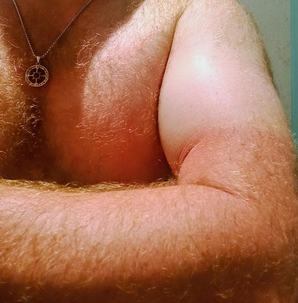 Ein einizger Tag Sonne führt hierzu... :-)
