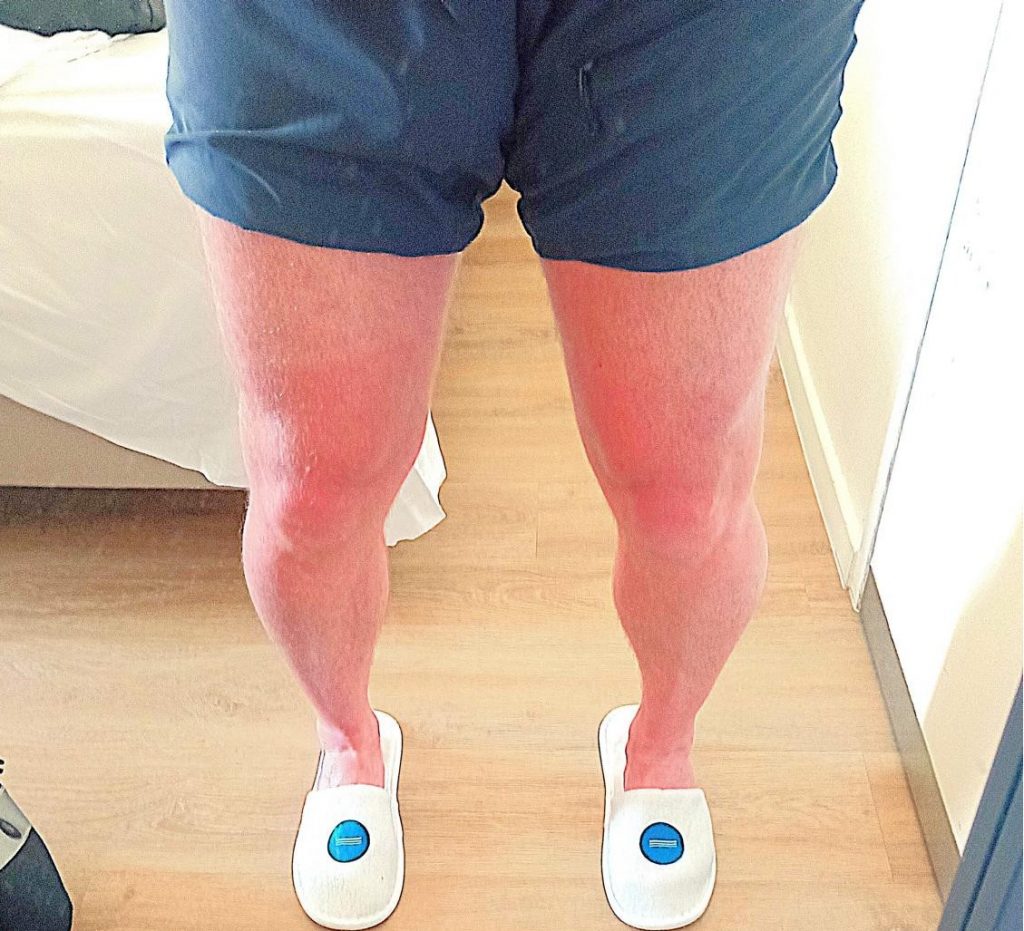 Endlich Sonne!
